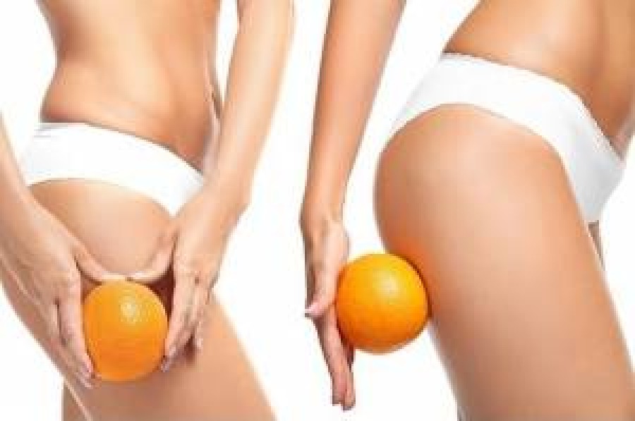 Everything you need to know about cellulite and its treatment!
