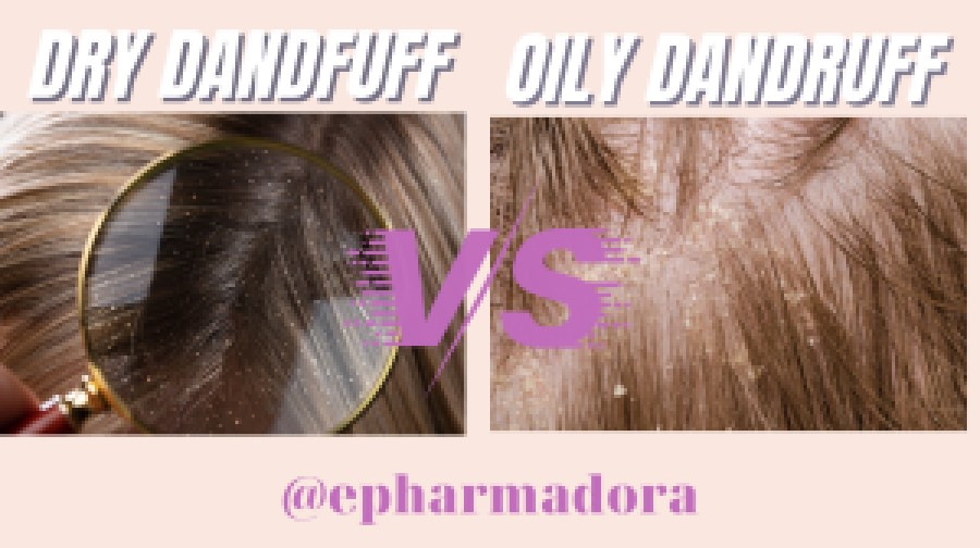 How to win the war against dandruff!     