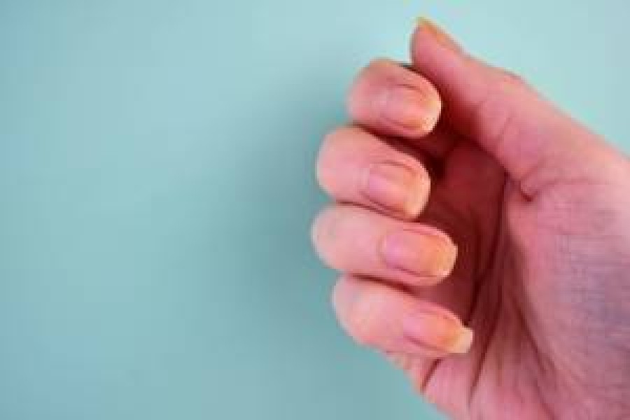 All you need to know about your broken nails