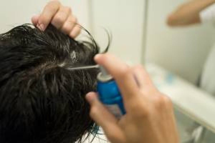 All about hair loss and how to treat it- Part 1